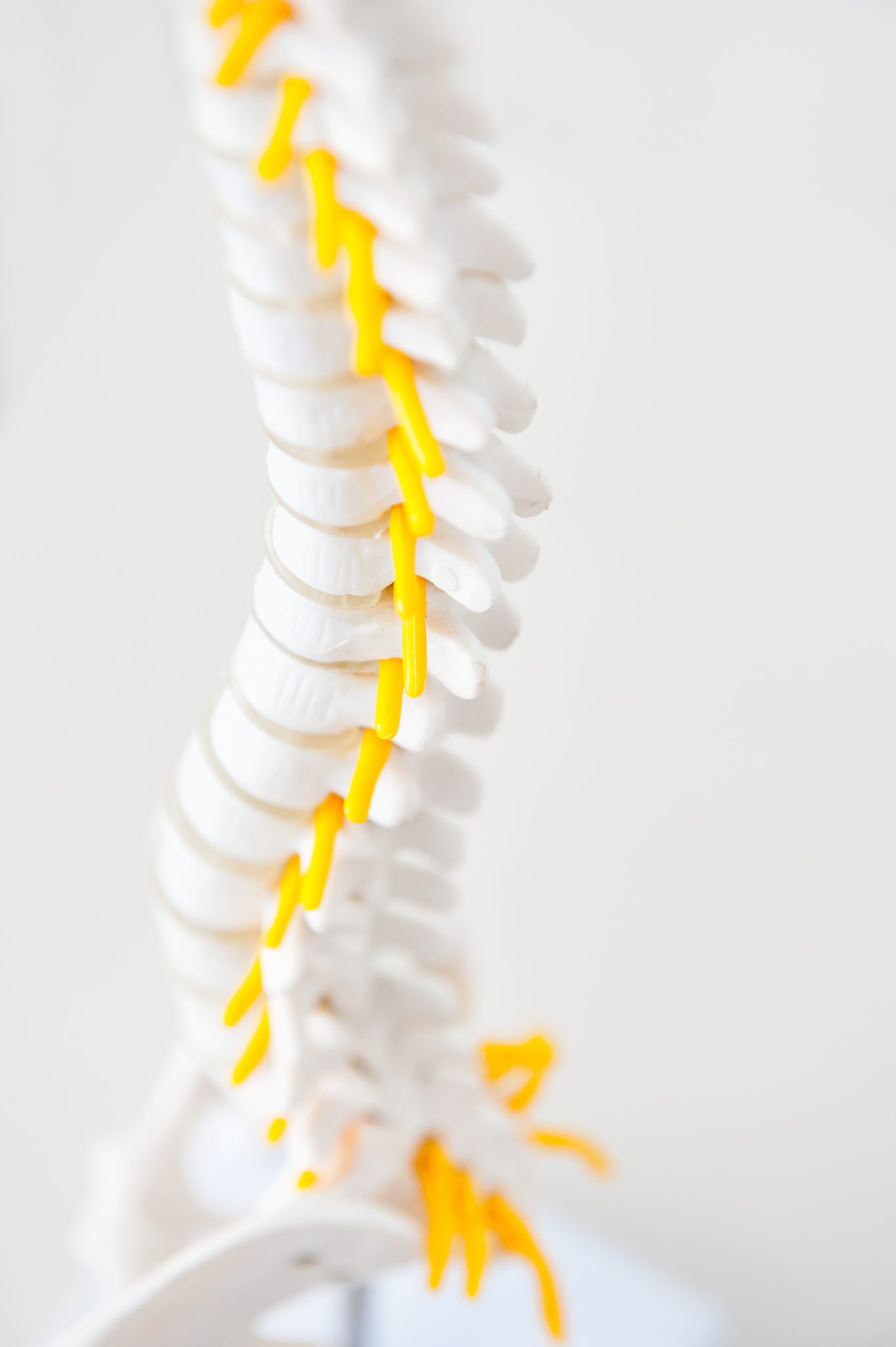 Chiropractic Family Wellness Center - What Happens If You Don’t Treat Spinal Misalignment?